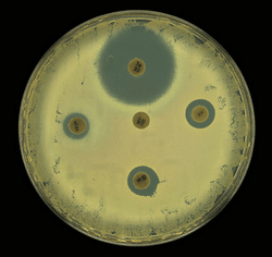 Salmonella e Campylobacter resistentes a antibióticos Salmonella e Campylobacter resistentes a antibióticos