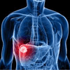Dia Mundial de Combate à Hepatite Dia Mundial de Combate à Hepatite