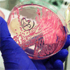 Autoridades relacionam surto de E. coli em França com o da Alemanha Autoridades relacionam surto de E. coli em França com o da Alemanha