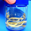 Ascaris lumbricoides